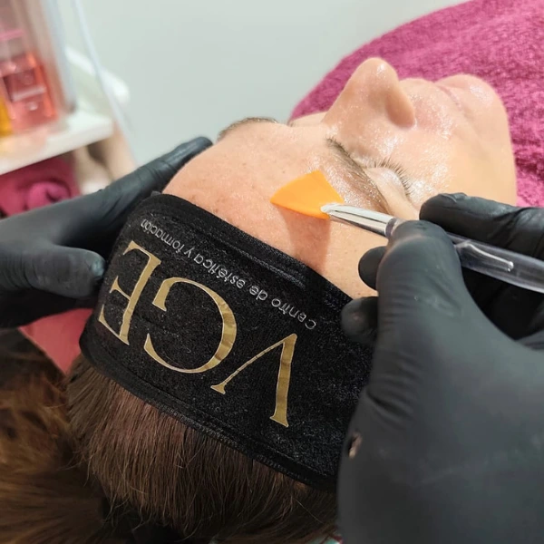 Frascos de ácidos profesionales para peeling
